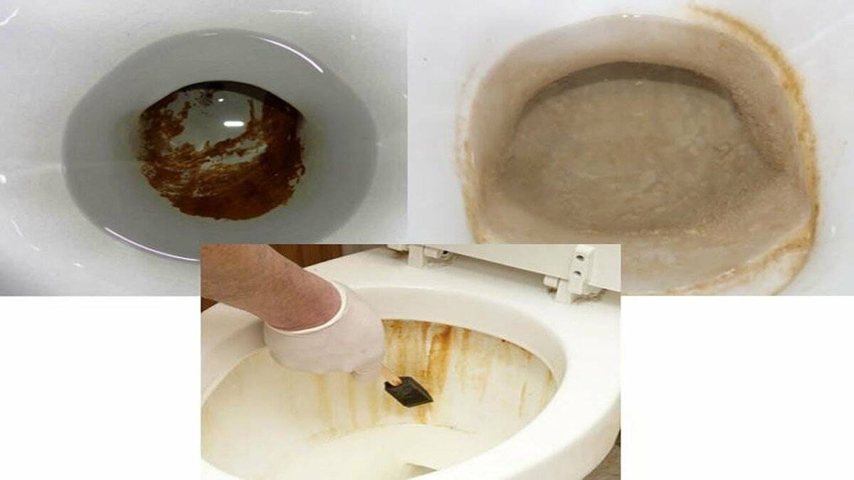 Как очистить унитаз от мочевого камня и известкового налета в домашних условиях при помощи народных средств или бытовой химии