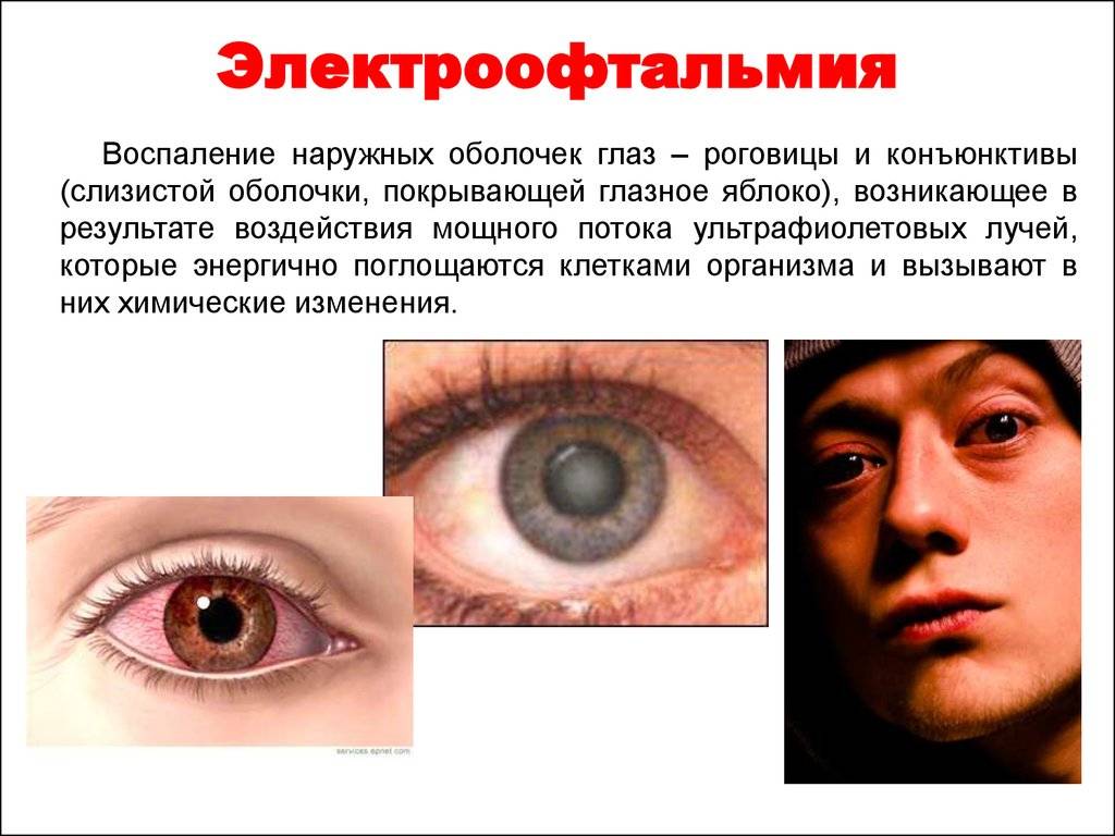Ожог слизистой глаза карта вызова